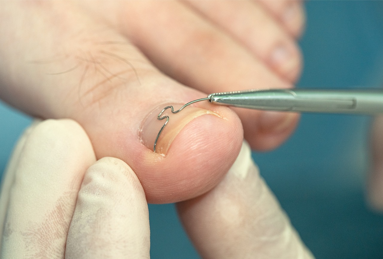 Significant drop in numbers waiting for Podiatry Services