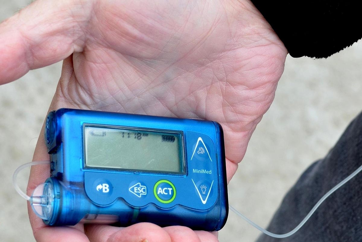 Diabetes patients left without essential insulin pump service